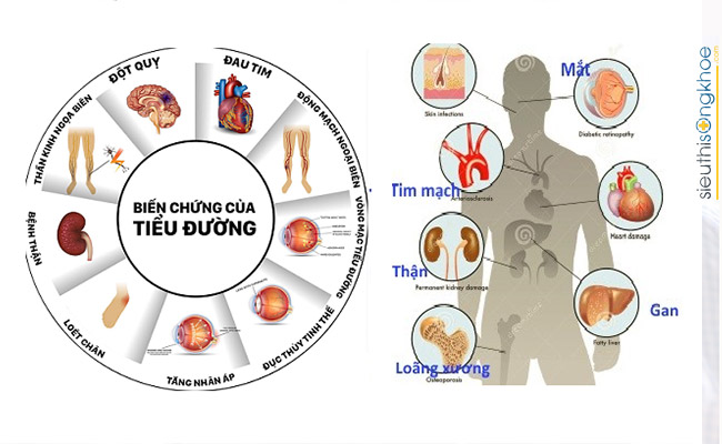 bệnh tiểu đường nên kiêng gì