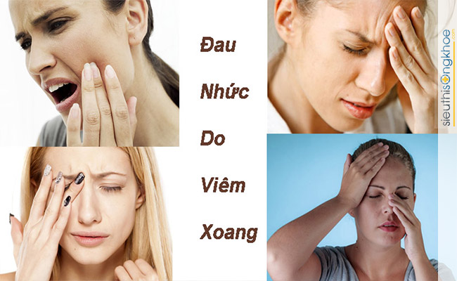 cách điều trị viêm xoang