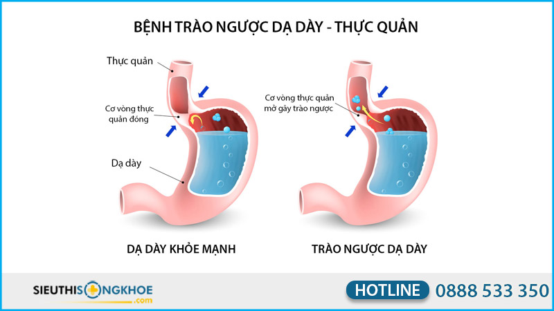 tỳ bách thảo có tốt không