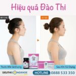 Bộ Sản Phẩm Đào Thi (uống + kem bôi) - Hỗ Trợ Tăng Kích Thước Vòng Một Săn Chắc, Tự Nhiên