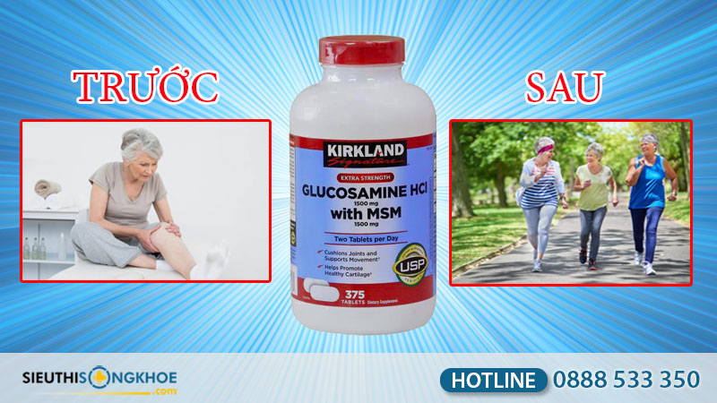 đánh giá kirkland glucosamine hcl 1500mg
