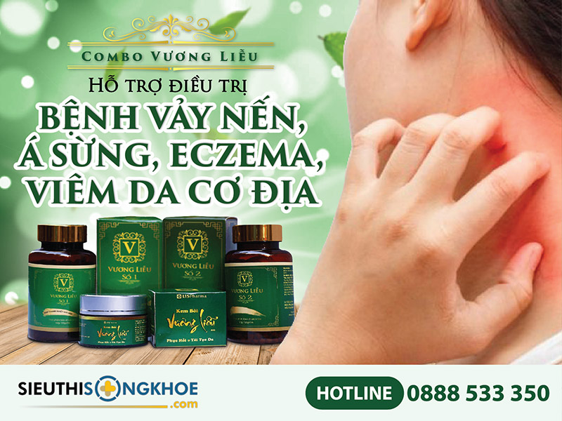 sản phẩm vương liễu