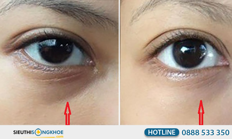 phản hồi khách hàng về obagi professional c eye brightener serum